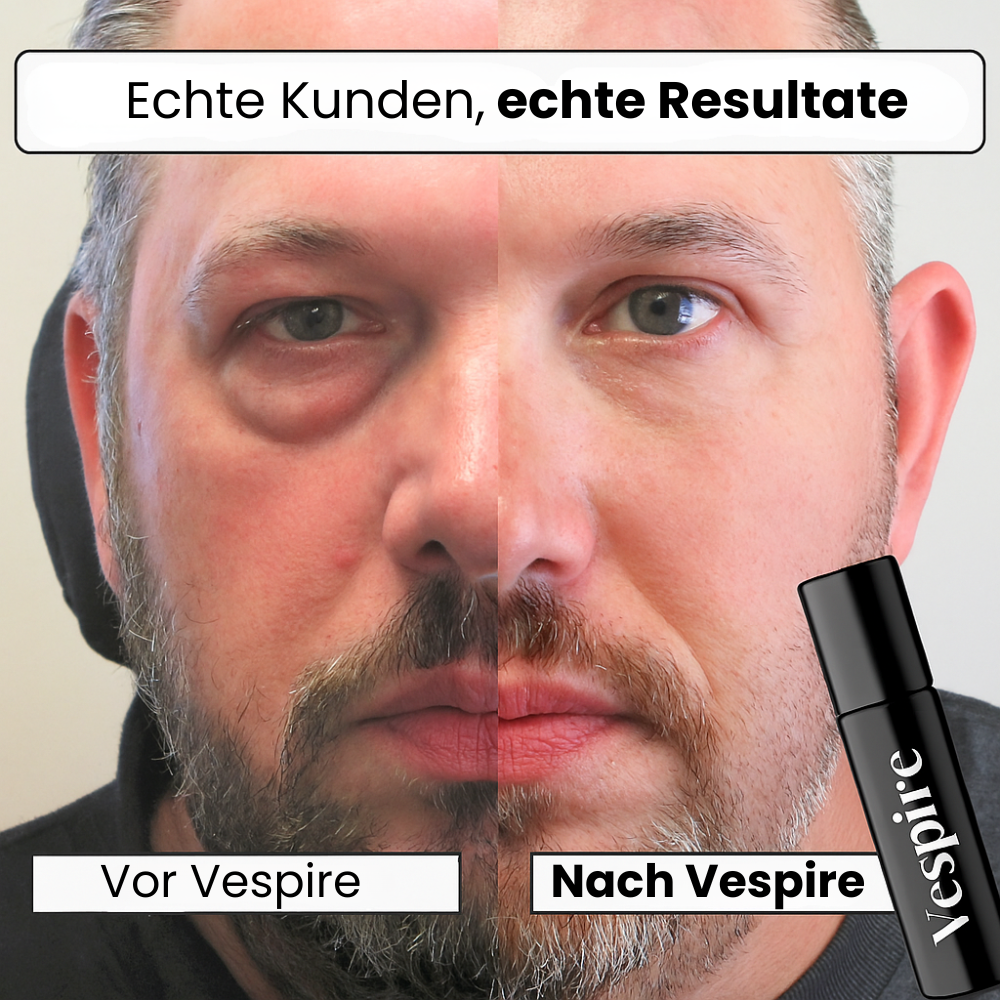 ANTI-AUGENRING-STICK™ (10ml)